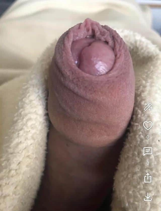 German Nudist Beach Penis
